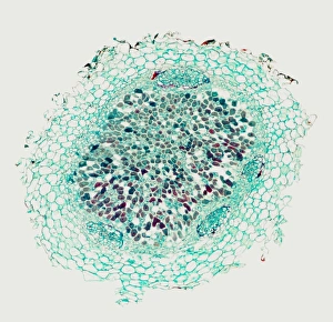 Drucke von Nitrogenspenderwurzelknoten. Lichtmikroskopische Aufnahme einer Schnittdurch ein Nitrogenspenderwurzelknopf von Faba vulgaris, die symbiotischen Rhizobium leguminosarum Bakterien (Lila) darstellt Bilder Datiert 2006 Oktober: Nährstofffixierendes Wurzelknoten, Mikrograf
