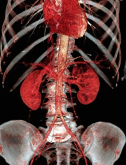 Normales Bauchbild, 3D-CT-Schnittstelle