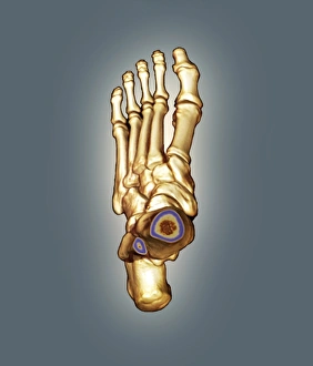 Drucke von Normales Fußgelenk, farbiges 3D-Computertomographie (CT)-Scan des gesunden Fußes eines 23-jährigen Patienten Bilder Datiert 2011 August: Normales Fuß, 3D-CT-Schnittbild