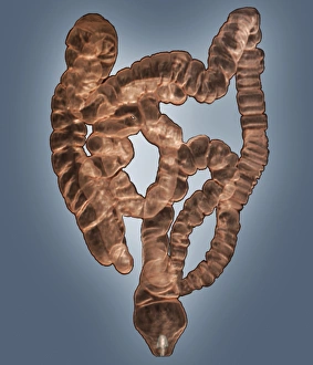 Human Digestive System Organs Drucke: Normal intestines, 3D CT scan