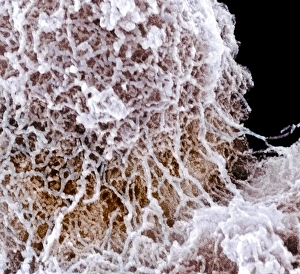Bilder Datiert 26. März 2009: Kernkörper,SEM