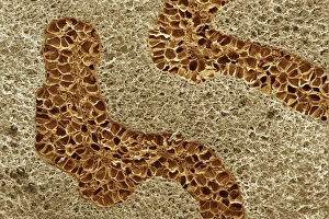 Myristica Fragrans Drucke: Nutmeg, SEM