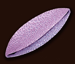 Pollen Grain Morphology Drucke: Orange pollen, SEM