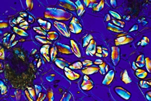 Polarised Light Microscopy Drucke: Orchid starch grains, light micrograph