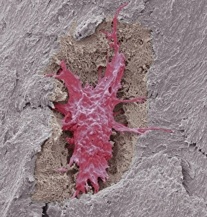 Bilder vom 21. August 2013: Oszeozyt Osthöhncell, SEM C016/9026