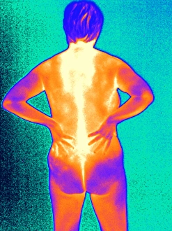 Drucke von Schmerzhafter Rücken. Thermogramm des nackten Weibes mit schmerzhaftem Rücken zeigt Variation im Temperaturniveau Bilder Datiert 2005 Februar: Rücken schmerz, Thermogramm