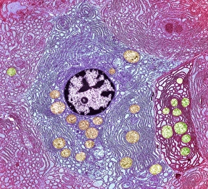Transmission Electron Micrograph TEM Drucke: Pancreas cell, TEM