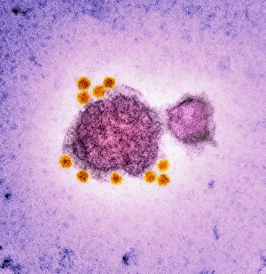 Coloured TEM Micrograph Drucke: Parvovirus particles, TEM