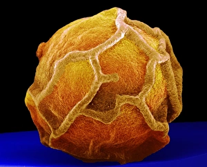Scanning Electron Microscopy Photos Drucke: Peppercorn, SEM