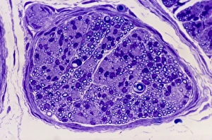 Nerve Cell Structure Drucke: Peripheral nerve, light micrograph