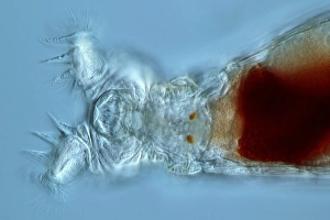 Bilder vom 6. September 2011: Philodina rotifer, Lichtmikroskop
