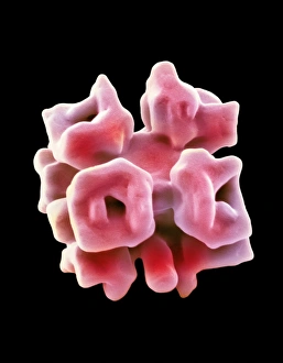 Coloured Scanning Electron Microscopy Images Drucke: Phosphate crystal, SEM