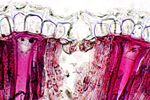 Polarised Light Microscopy Images Drucke: Pincushion leaf, light micrograph