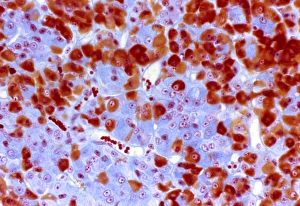 Drucke von Die Pituitärdrüsengewebe. Lichtmikroskopische Abbildung einer Schnittstelle durch die pars distalis, den vorderen Teil der Adeno-hypophyse in der Pituitärdrüse Bilder Datiert 2007 Dezember: Zysten des Hypophysengewebes im Lichtmikroskop
