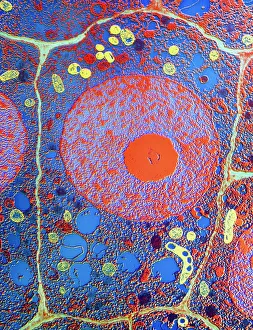 Transmission Electron Microscopy (TEM) Drucke: Plant cell