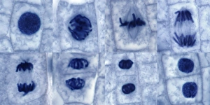 Cell Division Micrograph Drucke: Plant cell mitosis, light micrograph