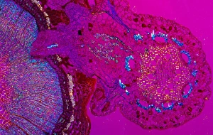 Parasitic Plants Drucke: Plant parasite, light micrograph