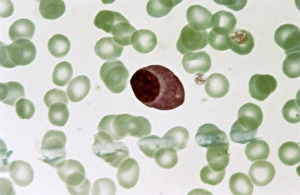 Blutplasmazyt Zelltyp, Leichtmikroskopiebild