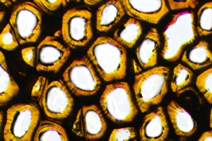 Drucke von Plasmodesma pflanzenzellen. Lichtmikroskopische Abbildung einer Schnittstelle durch intrazelluläre Brücken (plasmodesmaszelle) in der Frucht eines Strohanfressers (Strychnos nux-vomica) Bilder Datiert 2009 Oktober: Zellplasmoide pflanzliche Zellen unter mikroskopischer Beleuchtung