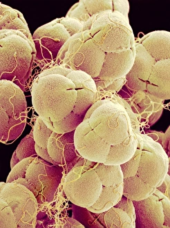 Pollen Grain Structure Drucke: Pollen of an azalea, SEM