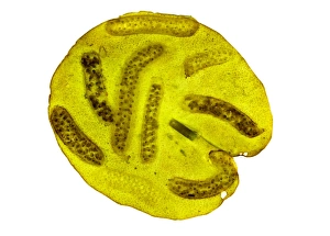 Light Micrograph Images Drucke: Pond snail egg masses, light micrograph