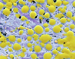 Bilder Datiert 15. Oktober 2002: Klebstoff von Post-It-Hinweisblatt, SEM (Scanning Electron Microscopy)