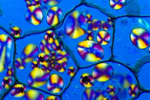 Polarised Light Microscopy Drucke: Potato starch grains, light micrograph