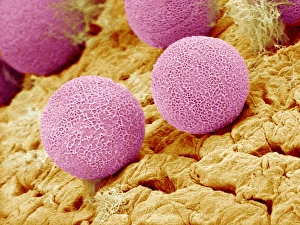 Scanning Electron Micrograph Of Pollen Drucke: Primrose pollen, SEM