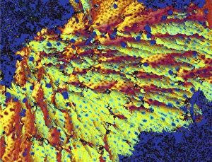 Polarised Light Microscopy Drucke: Progesterone hormone, light micrograph
