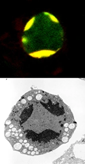 Programmed cell death