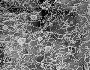 Scanning Electron Microscopy SEM Drucke: Protoplast showing cellulose microfibrils