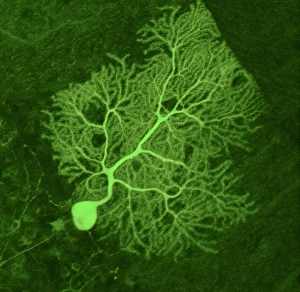 Bilder Datiert 20. Juni 2008: Zellkern des Purkinjes, Lichtmikroskopie