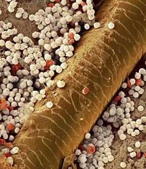 Coloured Scanning Electron Microscopy (SEM) Drucke: Pyoderma skin disease, SEM