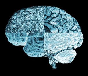 Neurology Images Drucke: Quartered brain