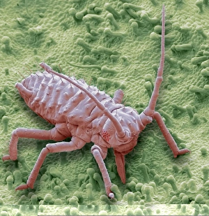 SEM Images Of Insects Drucke: Raspberry aphid, SEM C014 / 1430