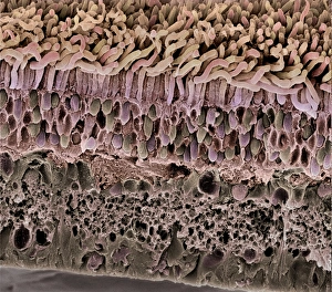 Human Eye Anatomy Drucke: Retina, SEM