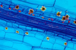 Polarised Light Microscopy Drucke: Rhubarb leaf, light micrograph