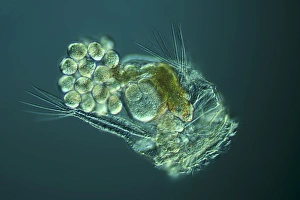 Bilder vom 7. August 2013: Rotifer mit Eiern, Lichtmikroskop C016/8587