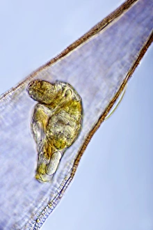 Bilder vom 23. März 2011: Ruderfuß Rotifer, Lichtmikroskop