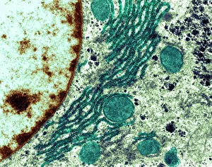 Bilder, datiert 2004: Unbeholfenes Endoplasmatisches Reticulatum, TEM