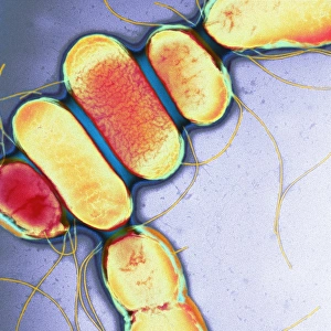 Salmonella Bacteria Drucke: Salmonella, TEM