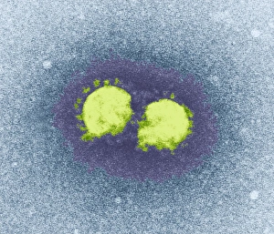Coloured TEM Images Drucke: SARS virus particles, TEM