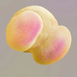 SEM Images Of Pollen Drucke: Scots pine pollen grain, SEM