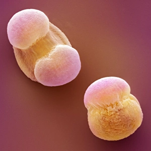Coloured Scanning Electron Micrograph Drucke: Scots pine pollen, SEM
