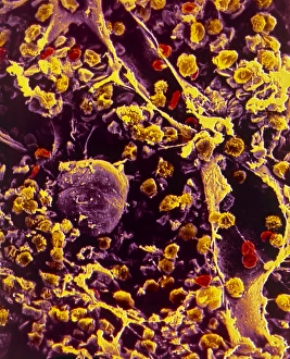 Human Body Bone Structure Drucke: SEM of bone marrow