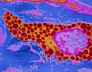 Immune System Cells Drucke: SEM of a human mast cell