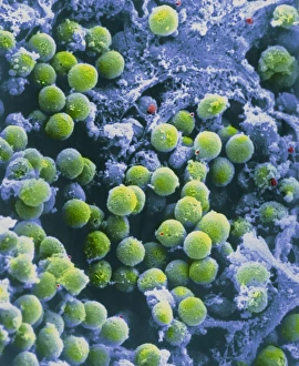 Human Immune System Cells Drucke: SEM of lymphocytes in cortex of thymus
