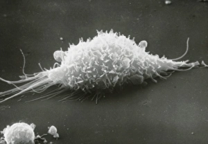 Drucke von Elektronenmikroskopiebild eines Makrophagenzells beim Bewegen über eine Oberfläche Bilder Datiert 2003 Juli: Zellmembran von einer Makrophagenzelle, die über eine Oberfläche bewegt wird