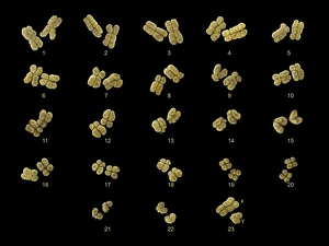 DNA Drucke: Vollsetzung männlicher Chromosomen, SEM