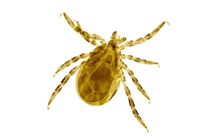 Light Micrograph Drucke: Sheep tick, light micrograph